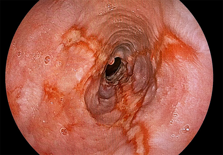 医師に尋ねるべき質問